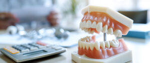 Why do patients need dental finance