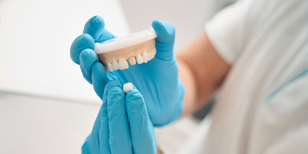 Benefits of investing in dental caps