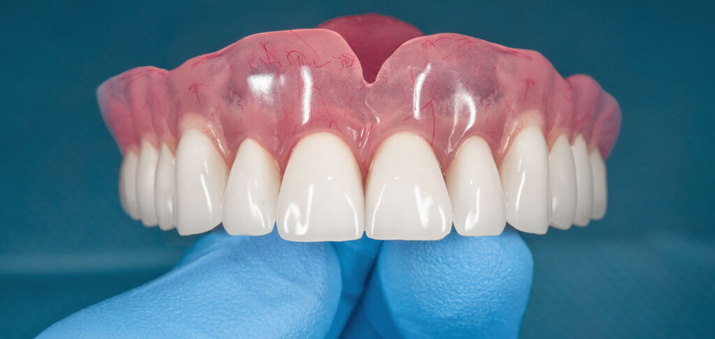 The procedure for getting a single denture for one tooth